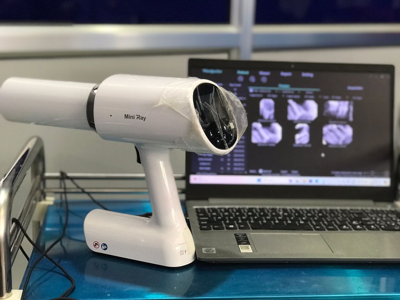 Digital Dental X-Ray